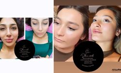 Miss Diana Güzellik'ten bir ilk! İğnesiz dudak dolgusu!