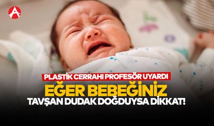Bebeğiniz “Tavşan Dudak” ile Doğduysa Dikkat! Uzman Uyarıyor
