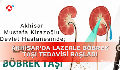 Akhisar’da Lazerle Böbrek Taşı Tedavisi Başladı