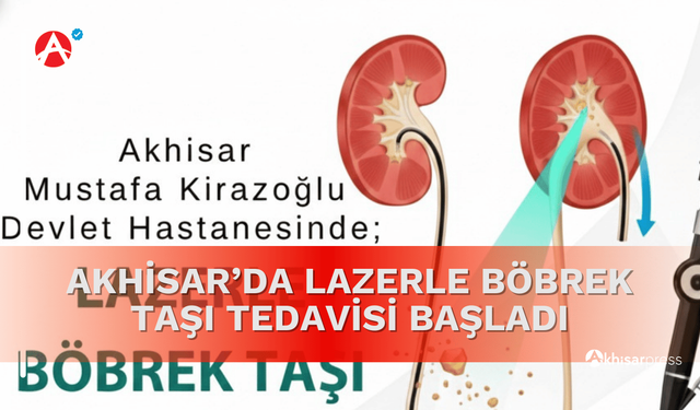 Akhisar’da Lazerle Böbrek Taşı Tedavisi Başladı