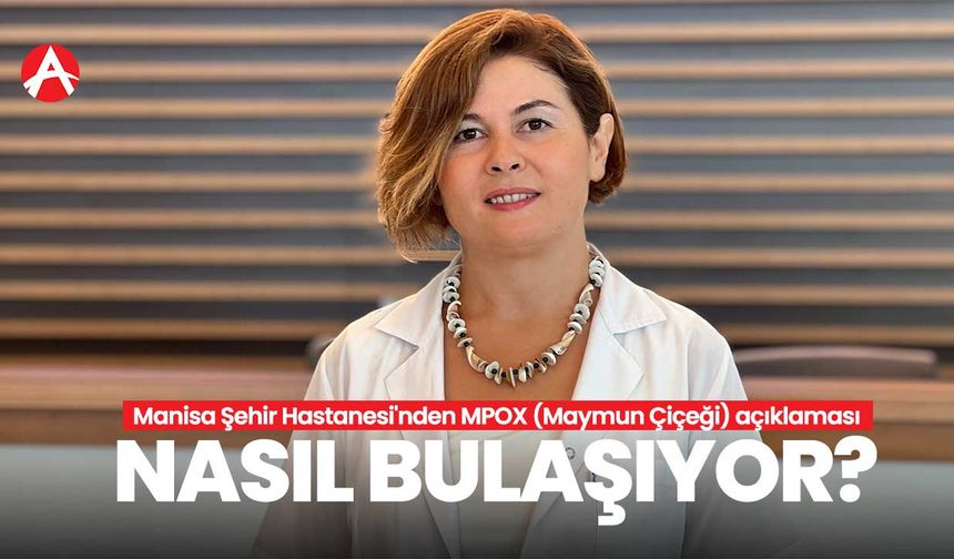 Manisa Şehir Hastanesi'nden MPOX (Maymun Çiçeği) açıklaması!